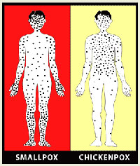 smallpox vs. chickenpox distribution