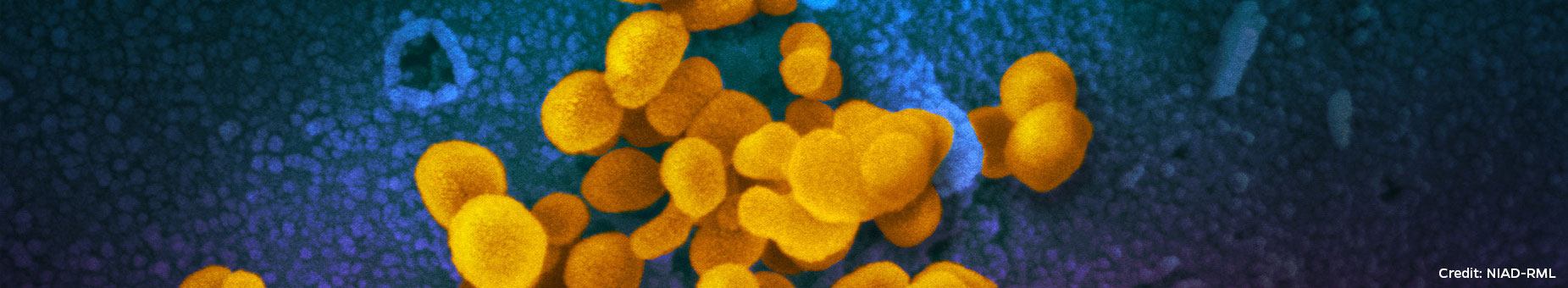 Image, A new coronavirus abstract virus