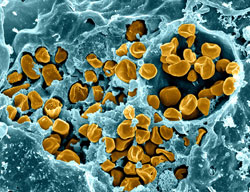 Microscopic image of F. tularensis